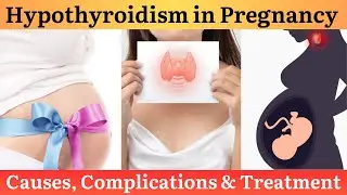 Can you get pregnant with hypothyroidism? / Explained in Malayalam