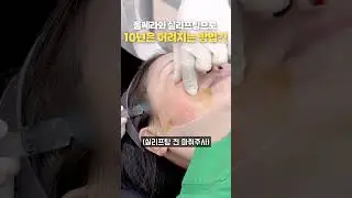 ep98. 울쎄라와 실리프팅으로 10년은 어려지는 방법! #shorts