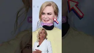 😱Николь Кидман испортила лицо косметологией #косметология #советыкосметолога #fullface