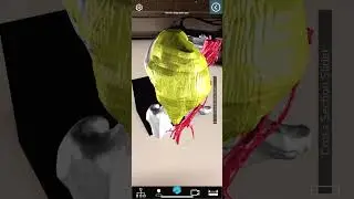 Augmented reality of patient with an iliac bone tumor using the Merge Cube