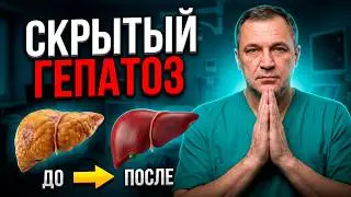 Fatty LIVER DISEASE: How to cleanse your liver of fat without pills?
