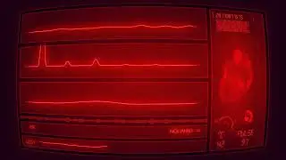 [FREE] EST GEE Type Beat - 4EVER | Nick Ianno Beats