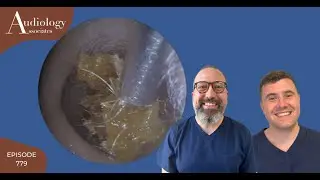 4 CM OF EAR WAX REMOVED/EARWAX & SKIN REMOVAL - EP779
