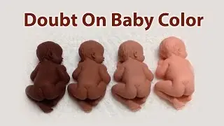 Doubt On Baby's Skin Tone? | KKMA