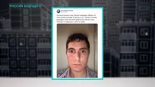 Алексей Навальный: о ЗВЕРСКОМ нападении на Низовцева