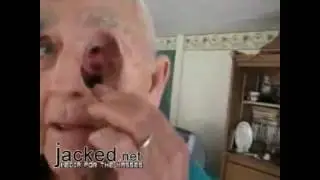 Holes on the face