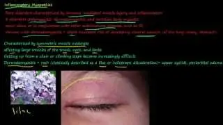 103P Polymyositis, Dermatomyositis, Inclusion body myositis, Mixed Connective Tissue Disease