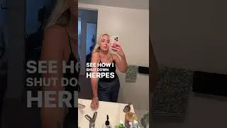 Breaking herpes stigma is very demure 💅✨ #demure #mindful #cutesy #hsv