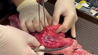 Formative Assessment for Wedge Resection of Simulated Nodules Using an Ex-Vivo Porcine Lung Model