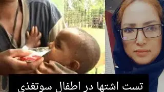 چگونه تست اشتها را برای اطفال سوتغذی انجام دهیم؟!