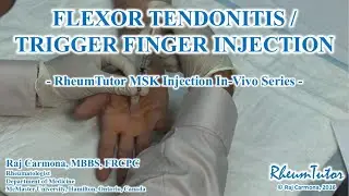 Flexor Tendonitis (Hand) Injection - In Vivo Series