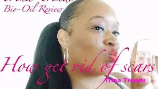Getting rid of scars, Review on Bio-Oil