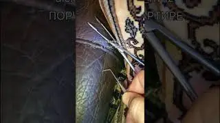 МОГИЛЬНЫЕ ИГЛЫ