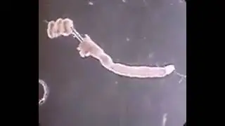 🐛Schistosoma mansoni macho robando una hembra del canal ginecoforal a otro espécimen macho.