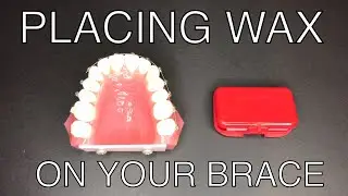 Placing wax on braces.