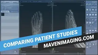 Rayence Part 9 - Comparing Patient Studies