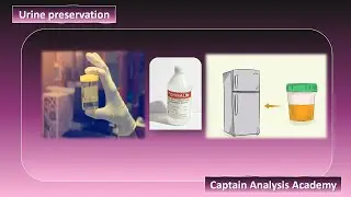 Urine preservation حفظ عينة البول لو مش هشتغلها على طول #urine