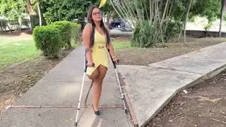 Amputee lady crutches user | life after amputation living free