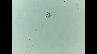 Vorticellidae do lago da Genética (IB-USP)