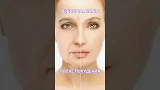 How to remove sagging skin after weight loss?