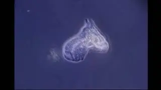 Just another Amoeba
