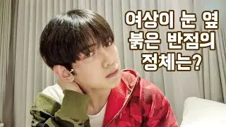 [ATEEZ\에이티즈] 여상이 눈 옆 붉은 반점의 정체는?