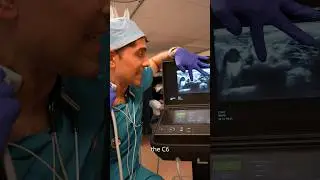 See my fight-flight nerve (Stellate Ganglion)