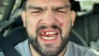 Kelvin Gasty OUT w/ Mouth Herpes, Sean Strickland MANNING UP
