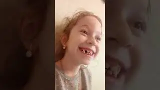 вырывание  зуба