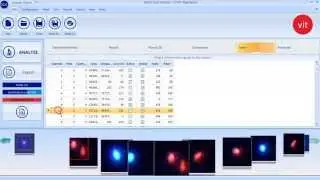 SCA Vitality - CASA System SCA Evolution (Human Edition)