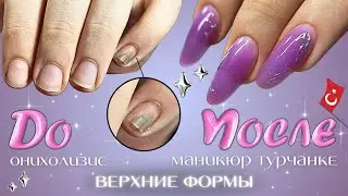 маникюр турчанке 🇹🇷 онихолизис, наращивание на верхние формы, эффект jelly nails 💜