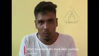 #hijama #cupping #hijamah #skincare #workout #fitness #gym #chiropractic #bangalore