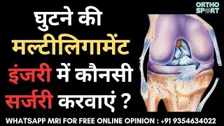 घुटने मे मल्टीलिगामेंट इंजरी में कौनसी सर्जरी करवाएं ? Screw, Internal Brace Multi-Ligament Surgery