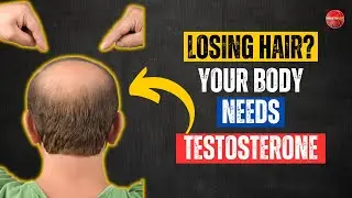 Under 30? You have Probably These Low Testosterone Sign | Losing Hair is One