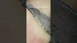 #shorts