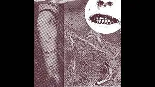 Echinostoma - Syphilis Parasite Commando