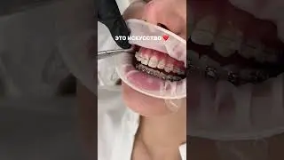 Ортодонтия - это искусство! Чувствуете?