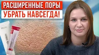 Как убрать ЧЕРНЫЕ точки? / Подбираем правильных уход за кожей