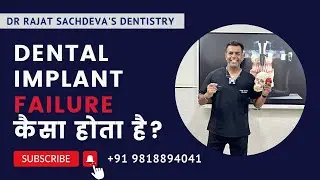 Dental Implants फेल क्यू होता hai । ड़ेंटल इम्पल maintaince | full mouth dental implants delhi