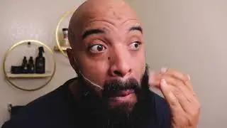 Raising the beard cheekline | 3 WEEK UPDATE!! | Making progress