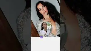 Что Дуа Липа делала со своим лицом? #dualipa #косметология #ботокс #контурнаяпластика