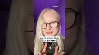 Какие плюсы быть альбиносом? 