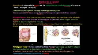 111P - What is a tumor?, Classification of Neoplasms - Benign and Malignant