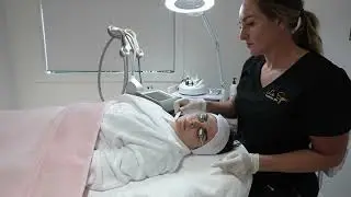 IPL Facial