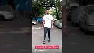 Types of Legs Shape | Body Posture #SHORTS