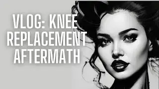 Vlog: My Knee Journey 🦵🏽 Patellofemoral Replacement