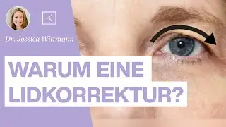 Wann ist eine Oberlidkorrektur sinnvoll? Die wichtigsten Gründe erklärt von DDr. Jessica Wittmann