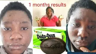 1 months results on dudu osun,  how to use it for any skin problems