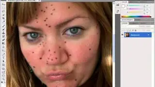 how to remove pimple from your face using photoshop