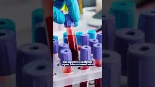 RESSONÂNCIA EM CHAPADINHA - MA #biocentro